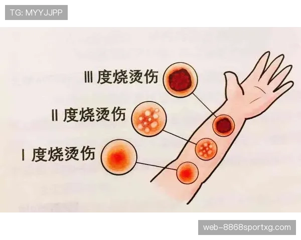 罢赛在足球规则中如何界定及其判罚流程详解